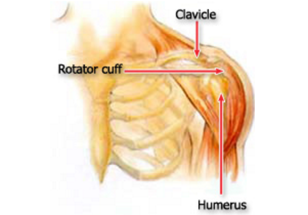 how the joint inflammation or injury bursitis develops how the joint inflammation or injury bursitis develops